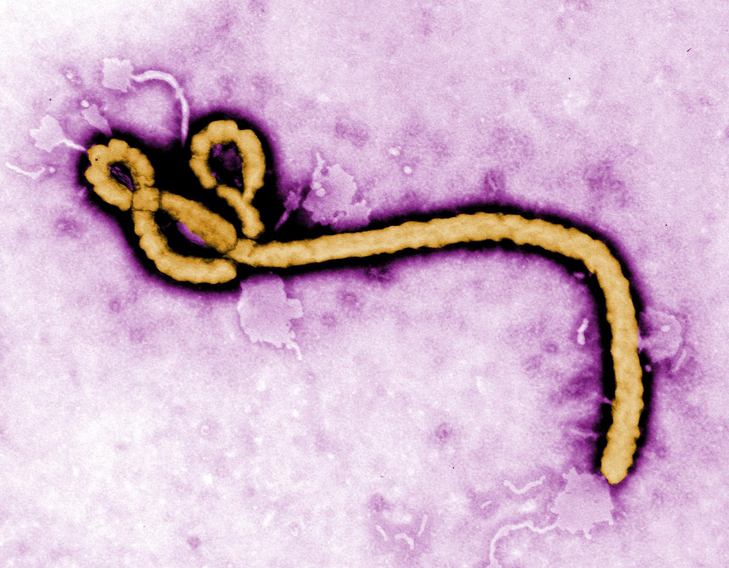 Le Virus Ebola